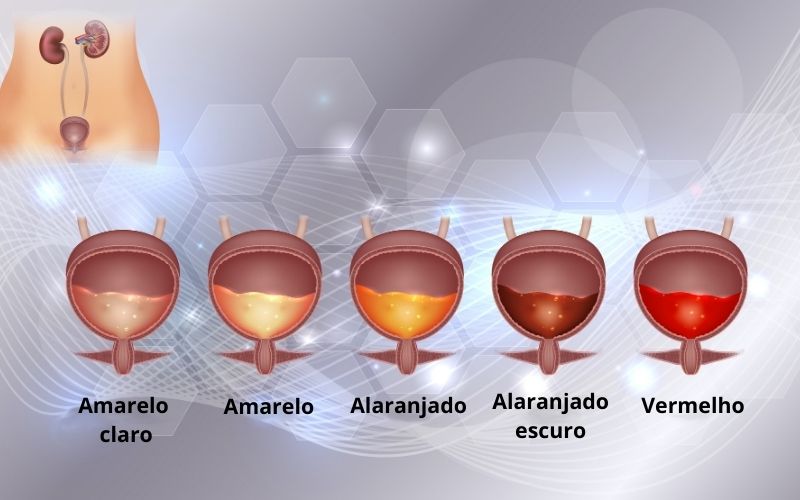 Diferentes cores da urina.